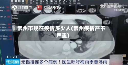 常州市现在疫情多少人(常州疫情严不严重)-第1张图片